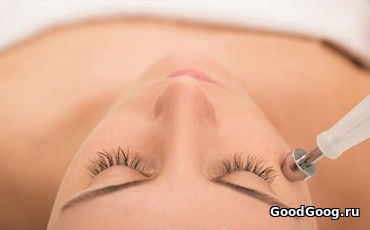 Мезотерапия